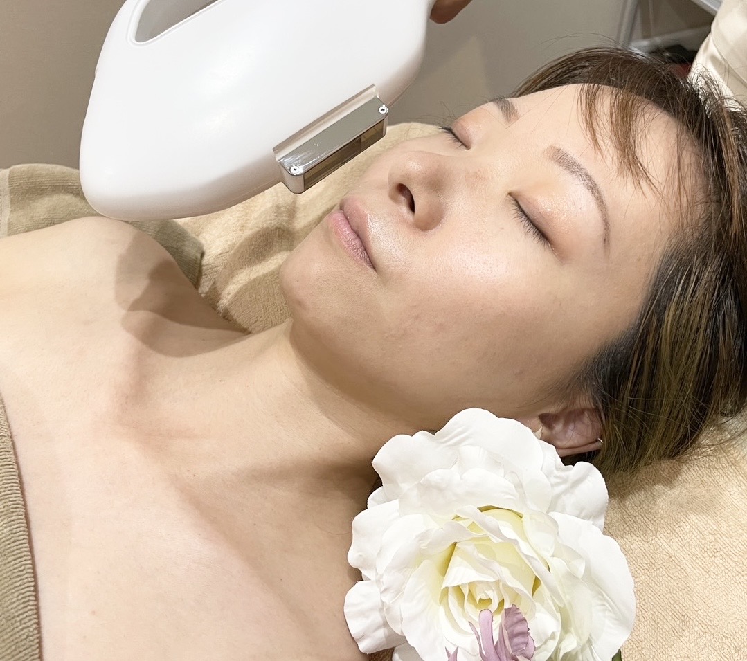 光フォトフェイシャル