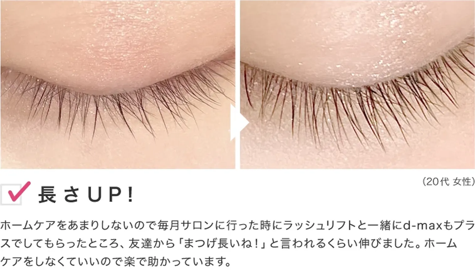 ビフォーアフター
